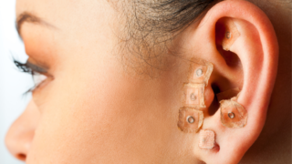 auriculoterapia